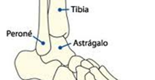 Luxación de articulacion tibio-peronea proximal aguda